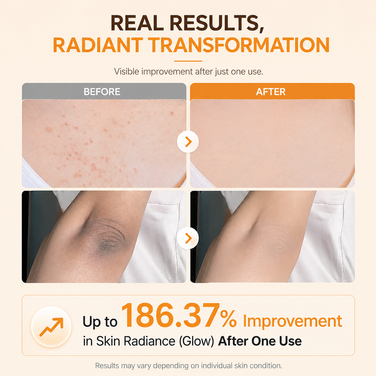Furalchemy Kojic Acid Turmeric Body Exfoliator Spray